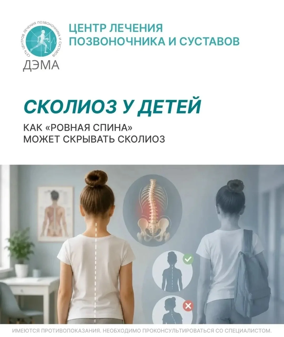 🔍 Как «ровная спина» может скрывать сколиоз?