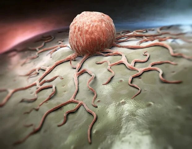 🔬 Мягкость опухолевых клеток связали с устойчивостью к CAR-T-терапии