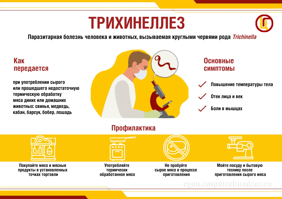 Трихинеллез
