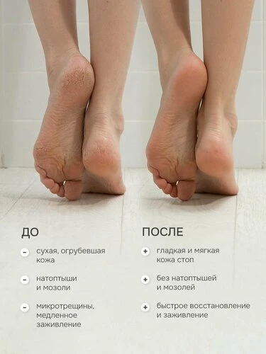 Часто мы так сосредоточены на общем состоянии здоровья, что забываем о мелочах, которые тоже влияют 