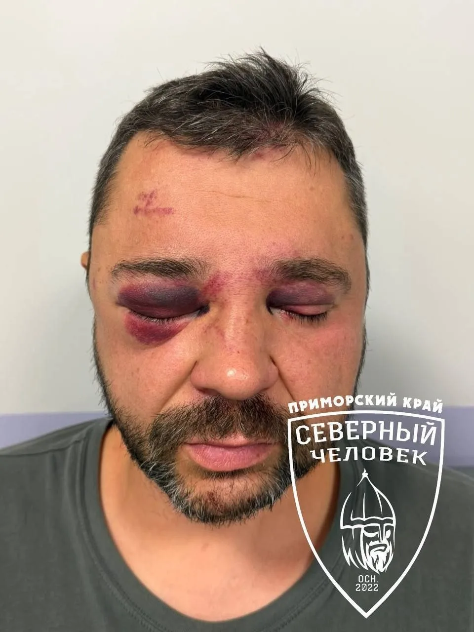 🚗😰 Мужчину жестоко избили на глазах у жены из-за парковки во Владивостоке