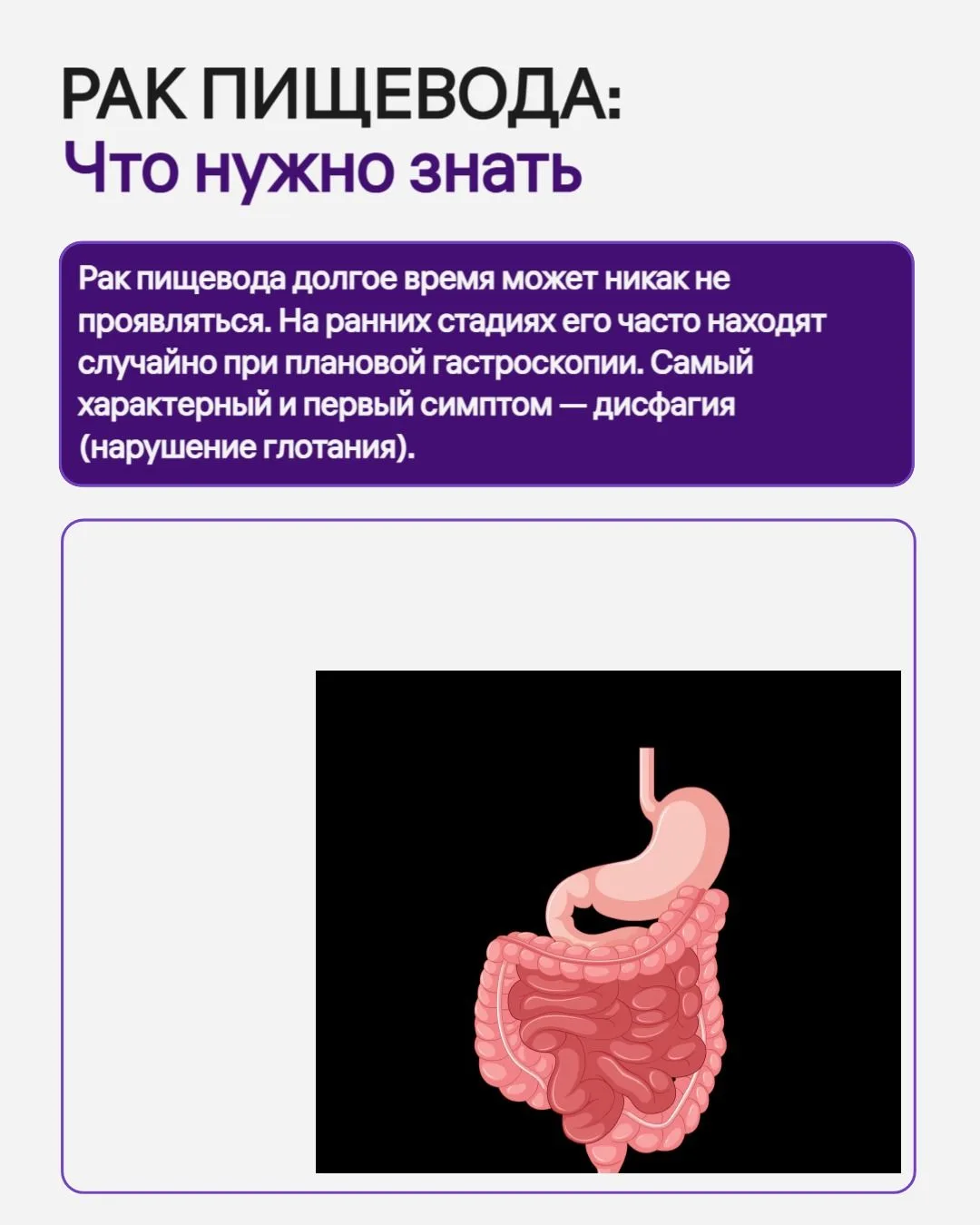 Рак пищевода долгое время может никак не проявляться. На ранних стадиях его часто находят случайно п