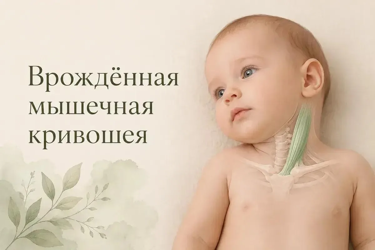 Кривошея - это патологическое изменение шейных мышц, сосудов или костей, при котором го...