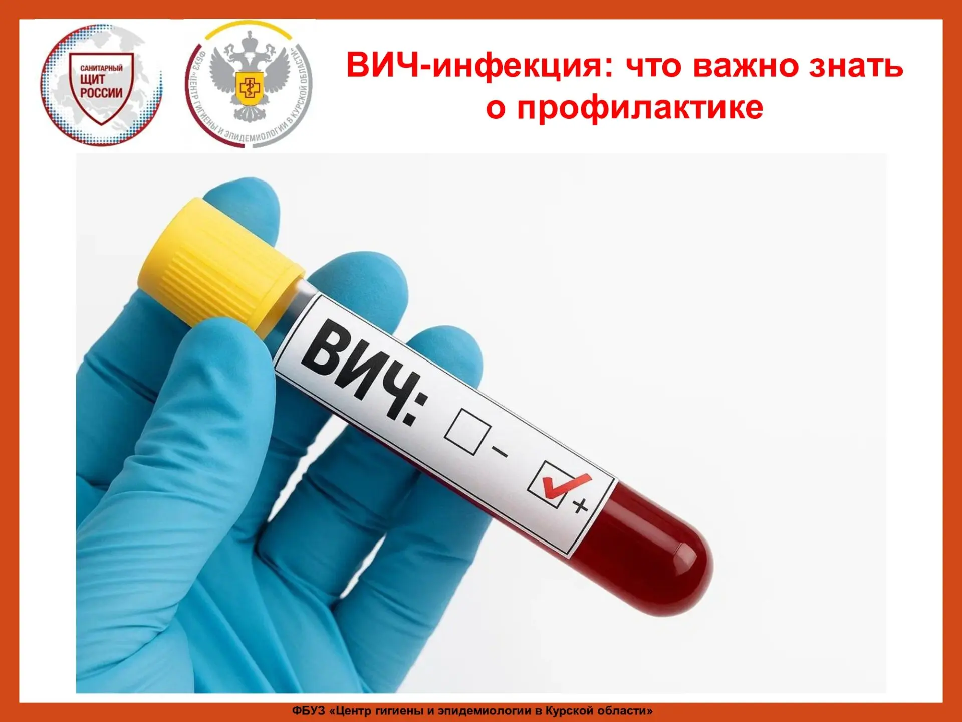 ВИЧ (вирус иммунодефицита человека) поражает иммунную систему.
