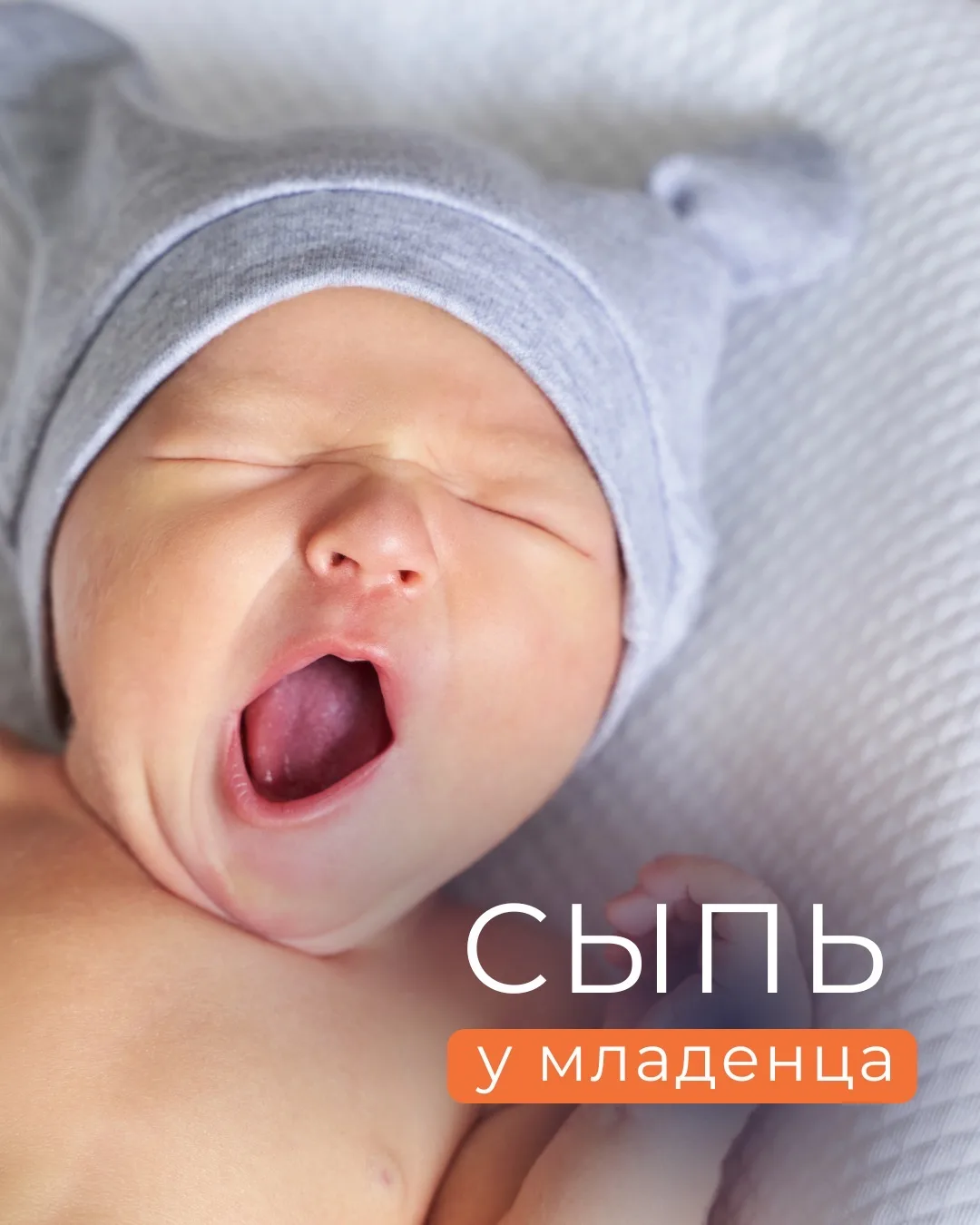 Сыпь у младенца — одна из самых частых причин тревоги родителей. И очень часто первое, ...
