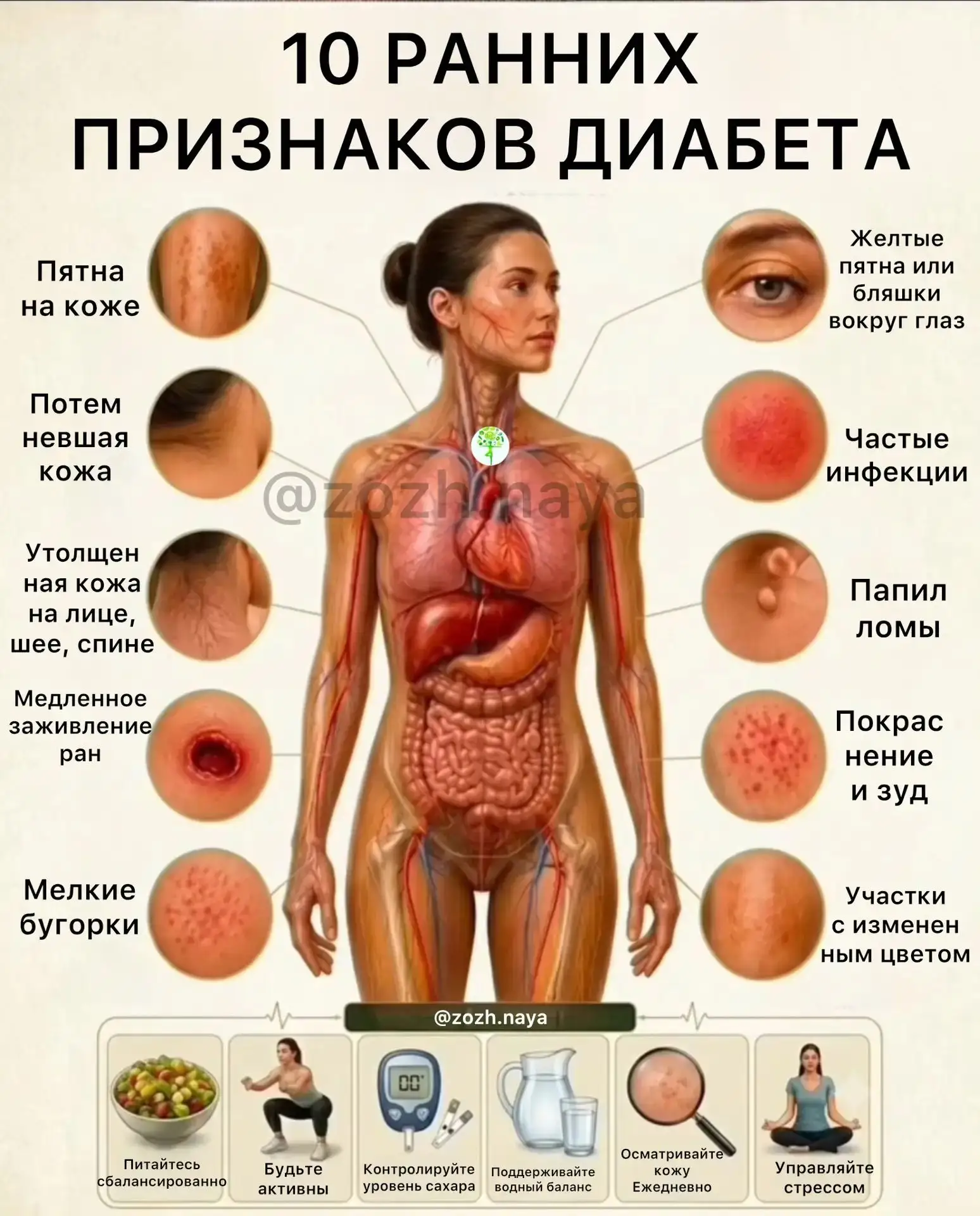 🩺 Диабет часто развивается бессимптомно, поэтому распознавание ранних признаков может ...
