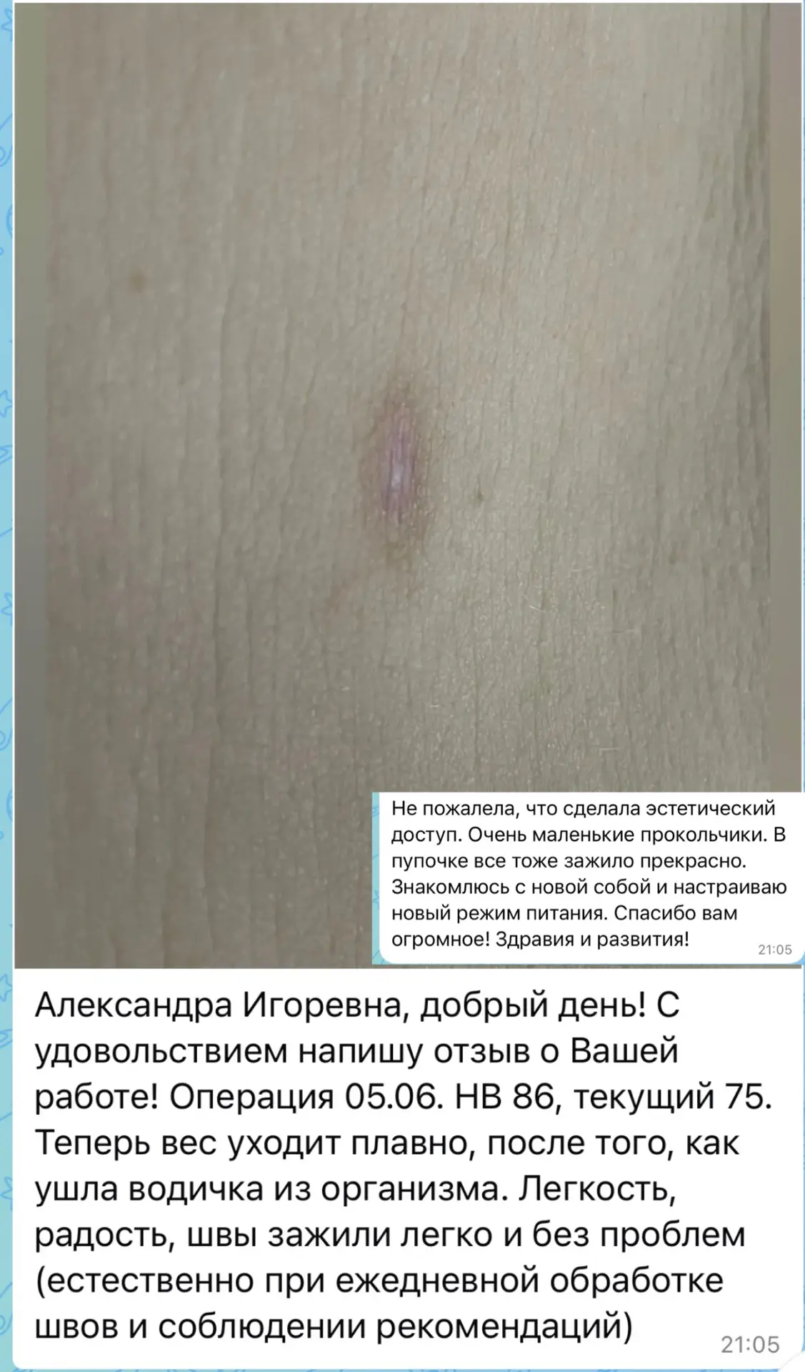 🙏 Вы большая молодец, что ответственно подошли к рекомендациям и обработке швов — именно благодаря 
