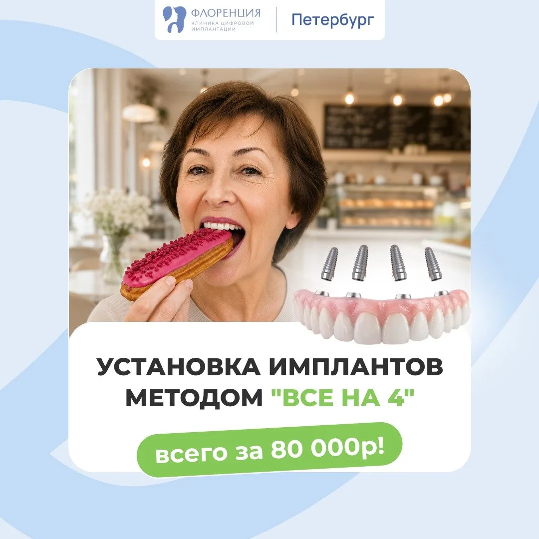 Имплантация по системе "Все зубы сразу на 4х имплантах"!