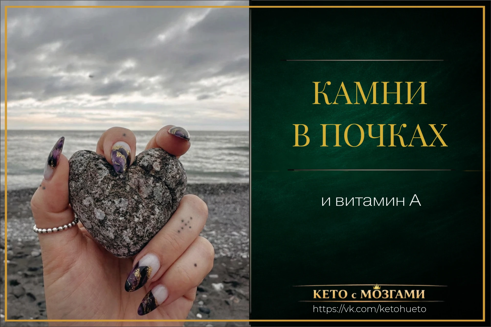Про камни в почках меня спрашивают очень часто.