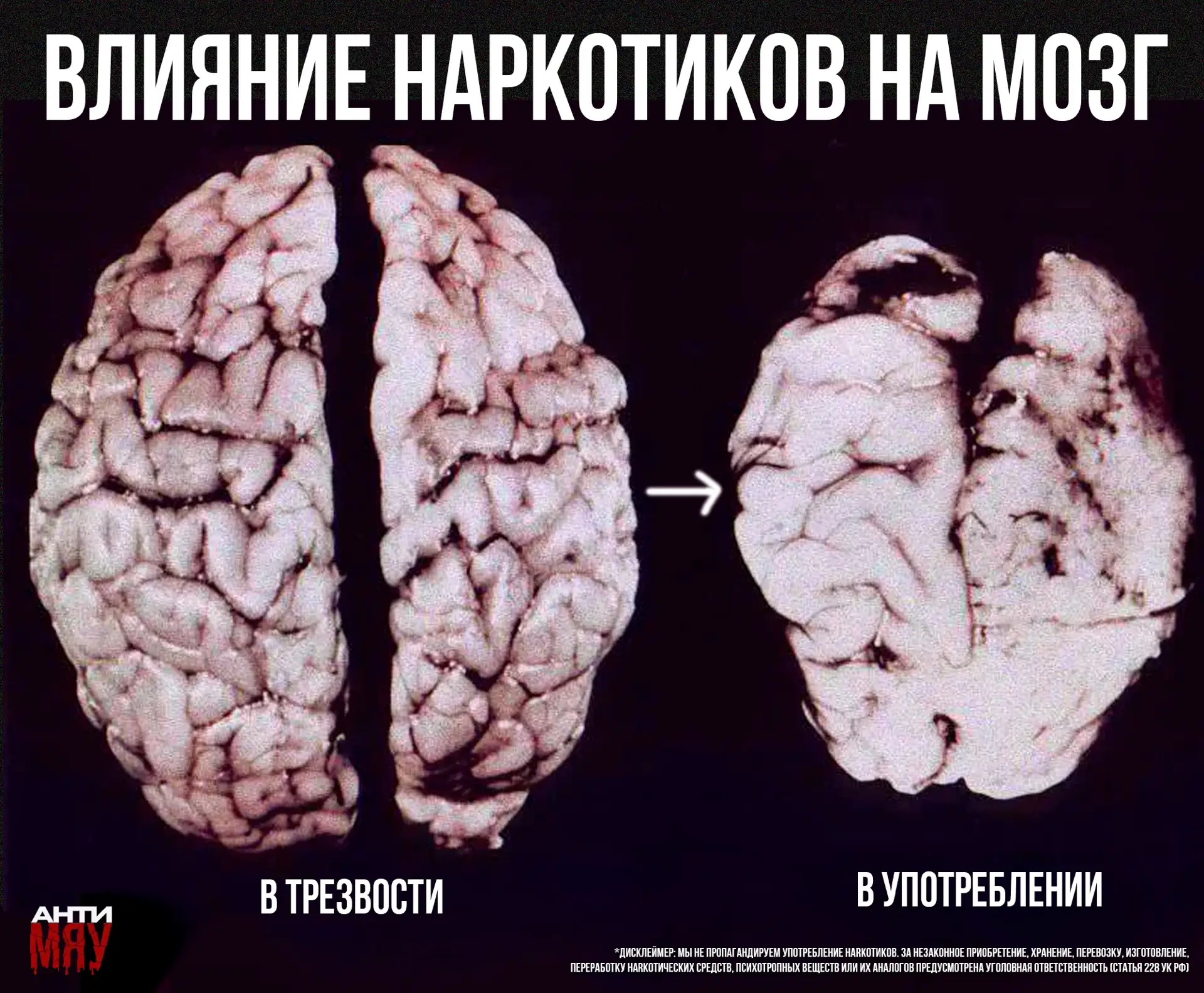 Влияние наркотиков на мозг