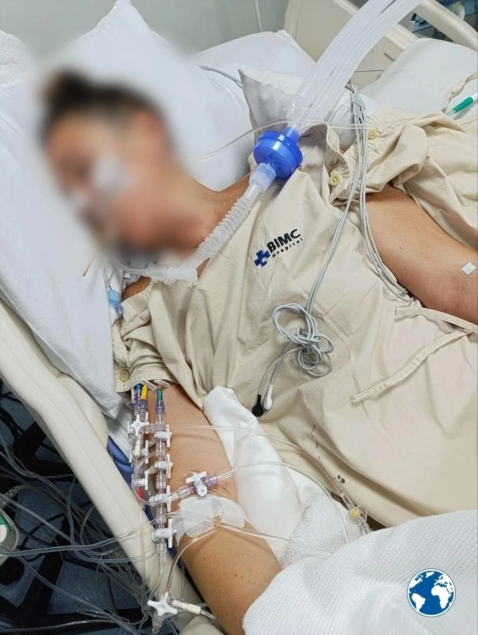 На Бали жительница Сочи впала в кому после бокала вина.

Анна со своим парнем прилетела на остров. В