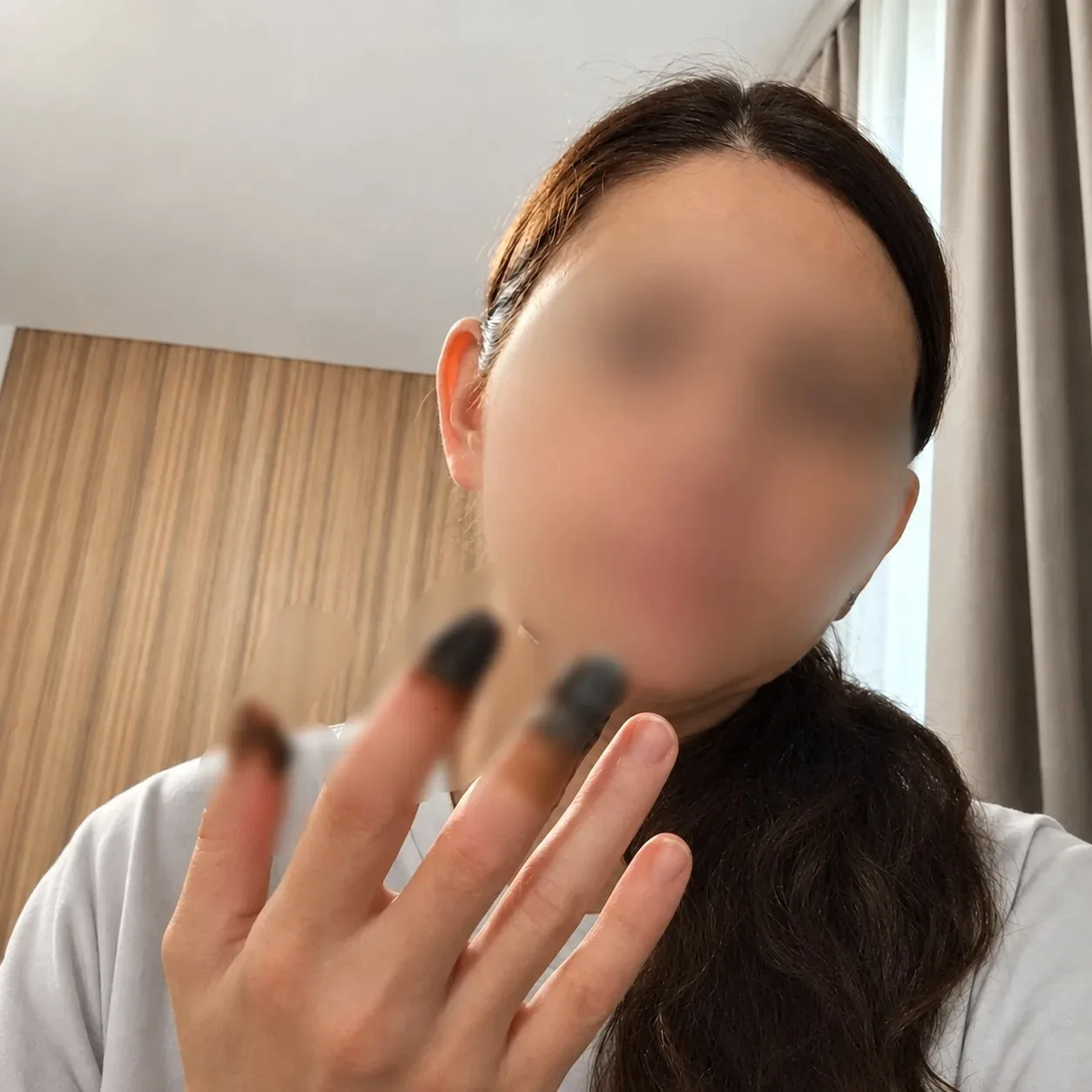 Жительнице Сочи после родов может потребоваться операция на пальцах