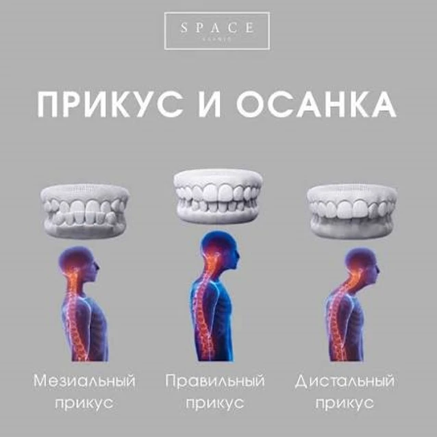 Прикус и осанка                                                                        ...