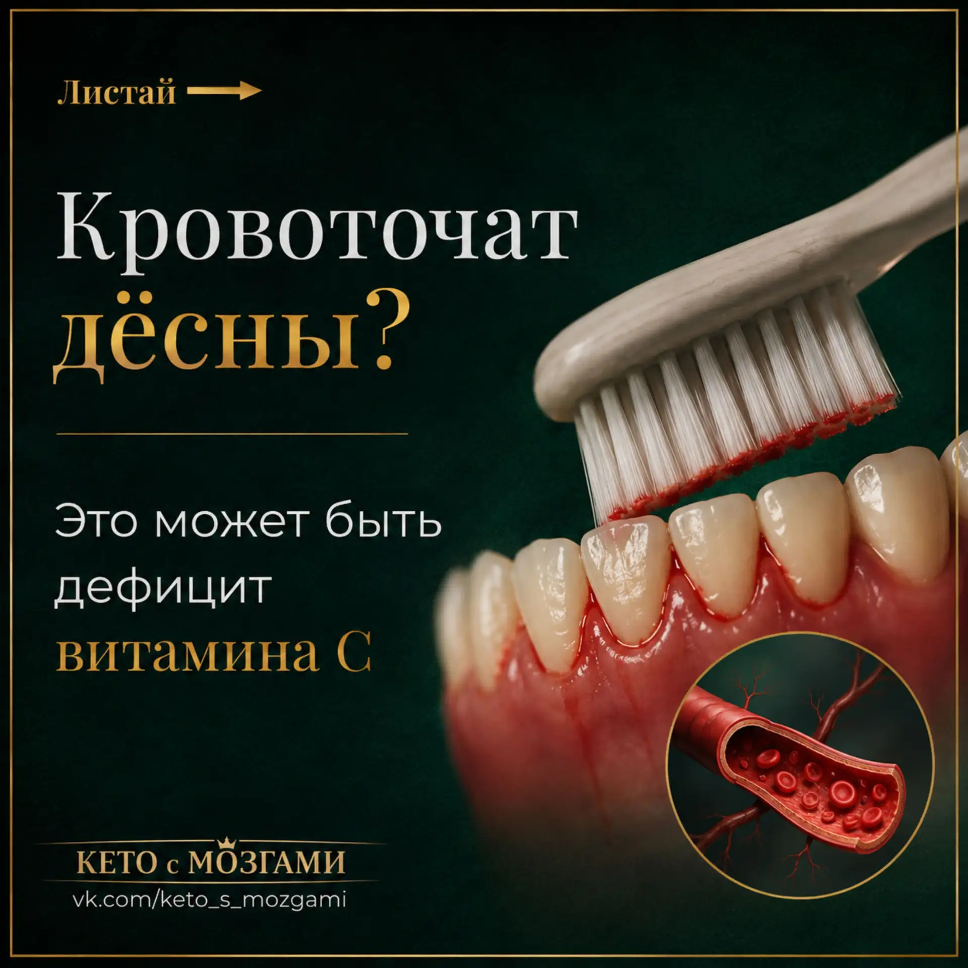 Дефицит витамина C, который многие не замечают