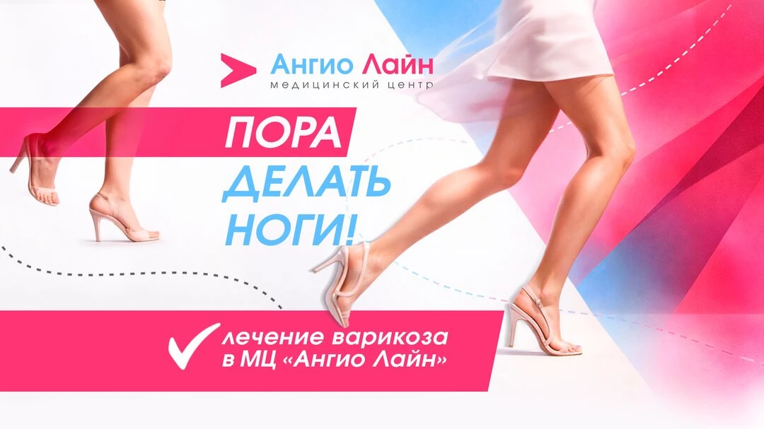 Лечение варикоза в МЦ «Ангио Лайн». 4 филиала в Екб