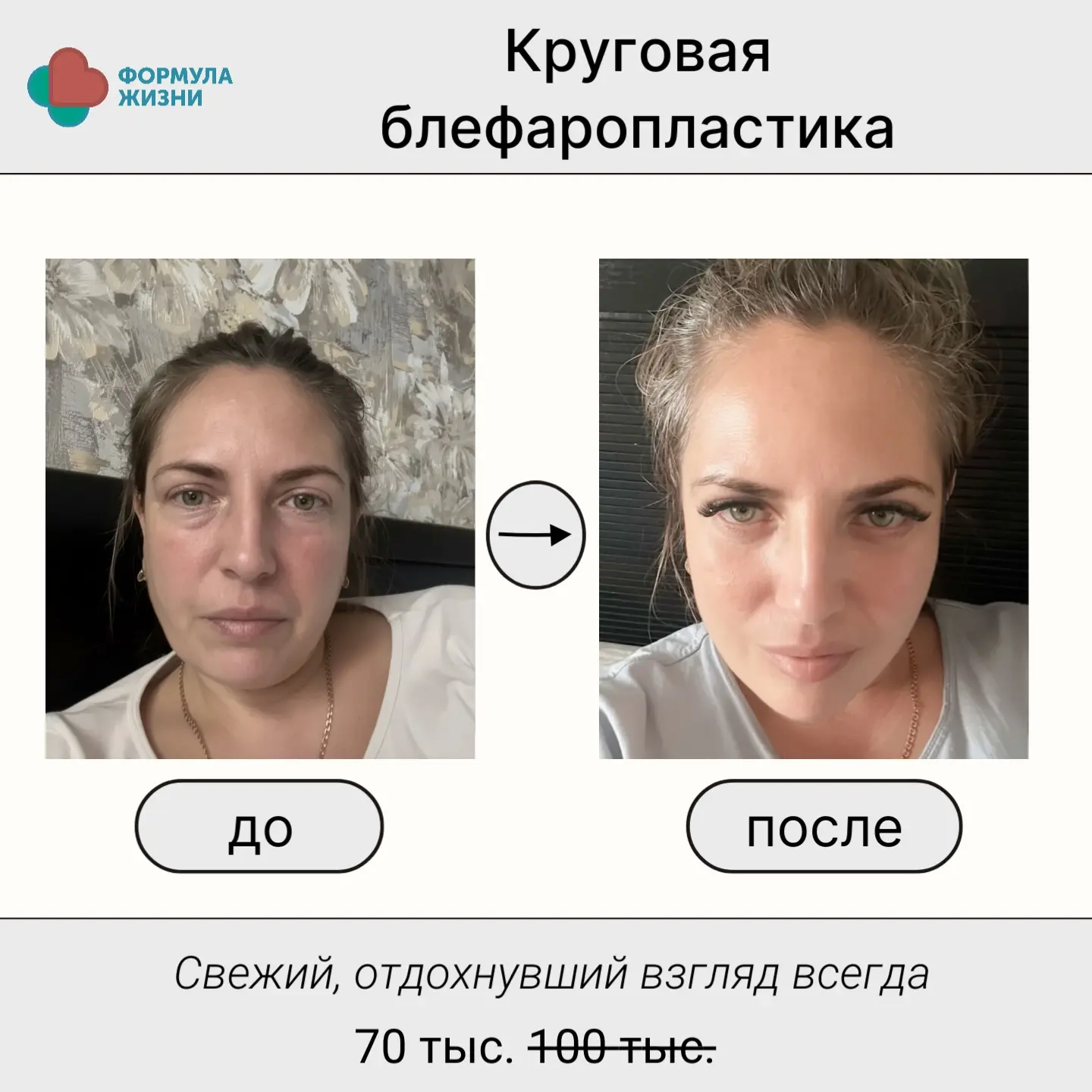 Акции июня