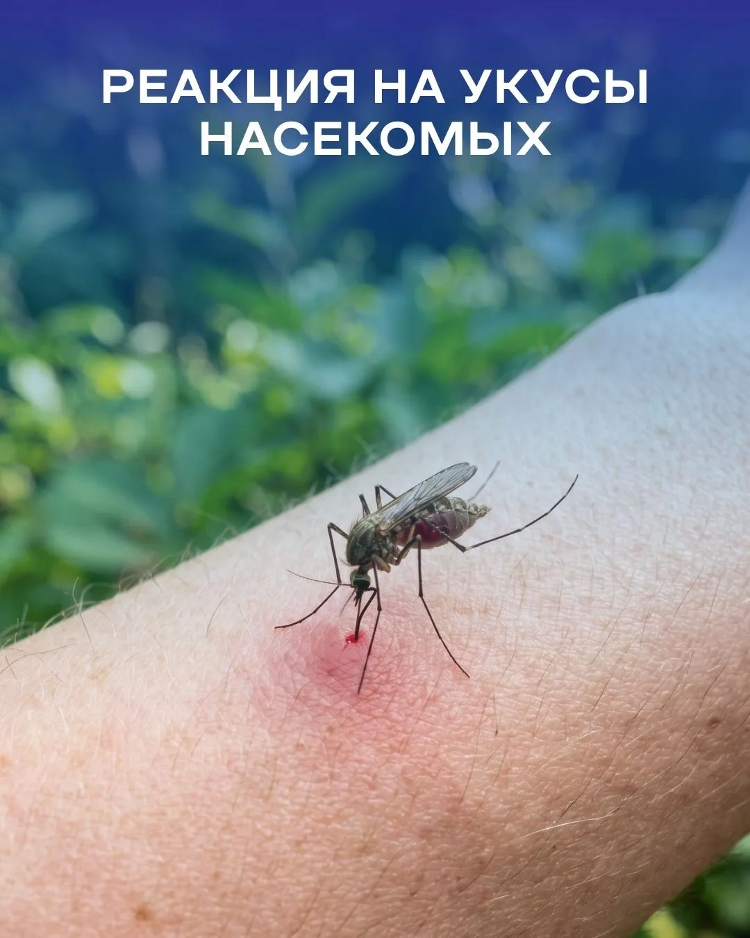 С первым солнцем мы привычно хватаемся за репелленты и ищем клещей на теле. Но зеленая ...