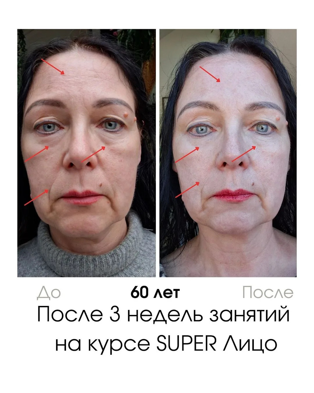 Изображение 3 к публикации «Гимнастика для лица»