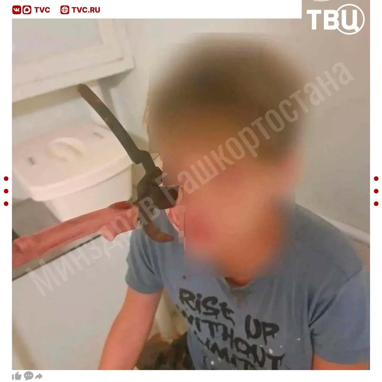 Секатор вонзился в лицо подростку — он едва не лишился зрения