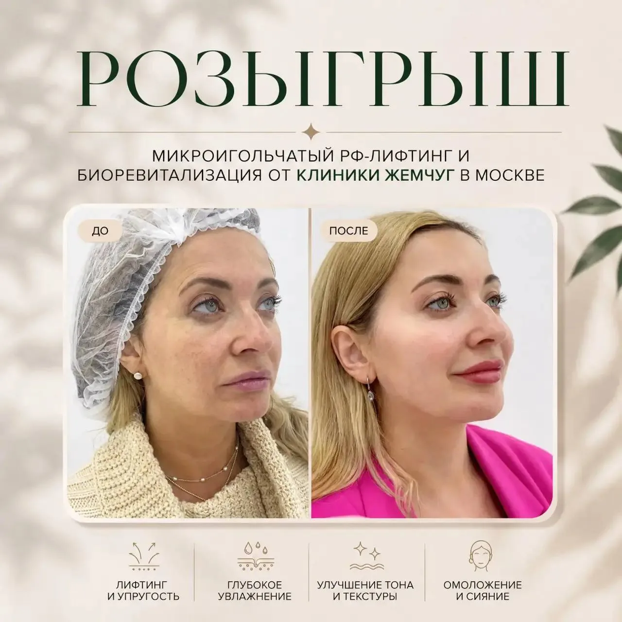 Москва, честный розыгрыш микроигольчатого RF-лифтинга и биоревитализации в разгар лета! 💋