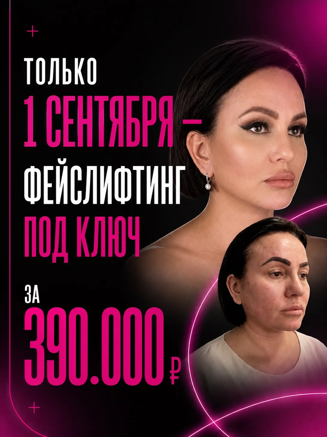 ТОЛЬКО 1 СЕНТЯБРЯ — ФЕЙСЛИФТИНГ ЗА 390.000 ₽ ПОД КЛЮЧ