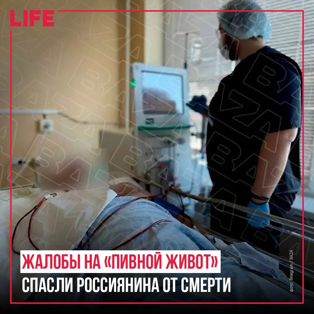 Житель Владивостока решил сбросить «пивной живот», а медики обнаружили у него критическ...