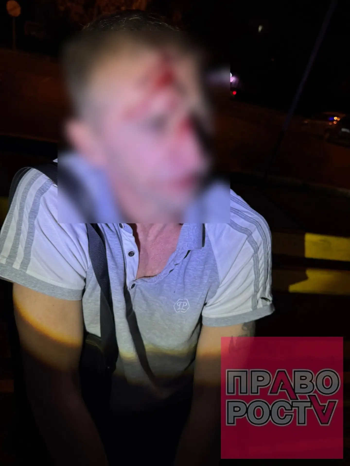🤯 Пьяный магнитогорец устроил дебош в кафе и напал на медиков