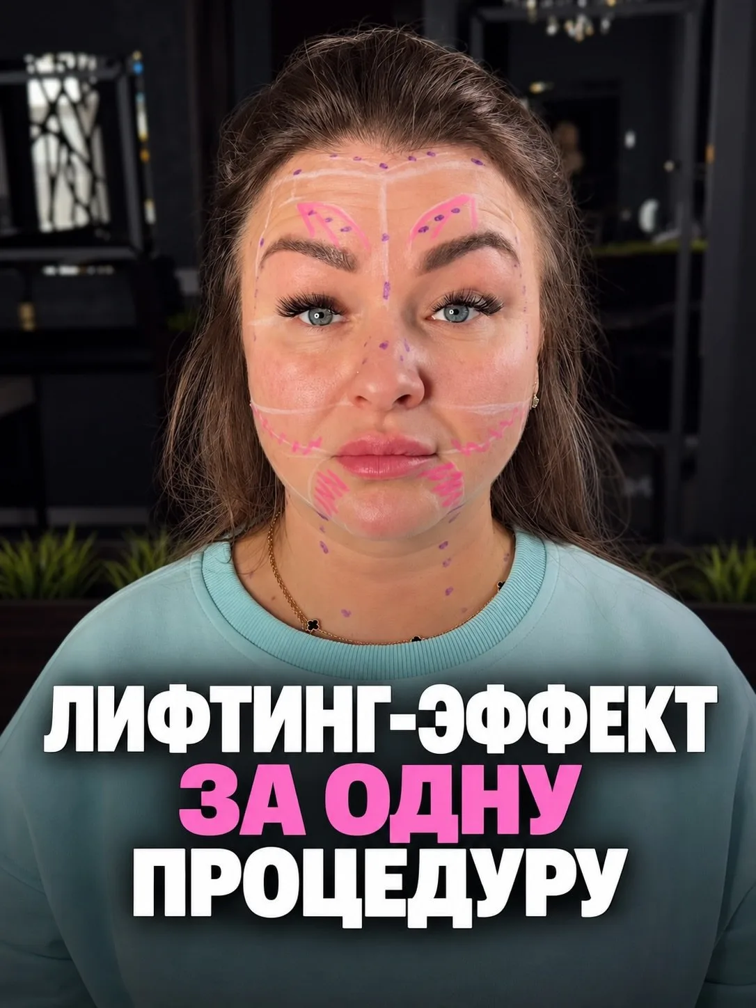 Full Face - комплексный подход к ботулинотерапии ✨