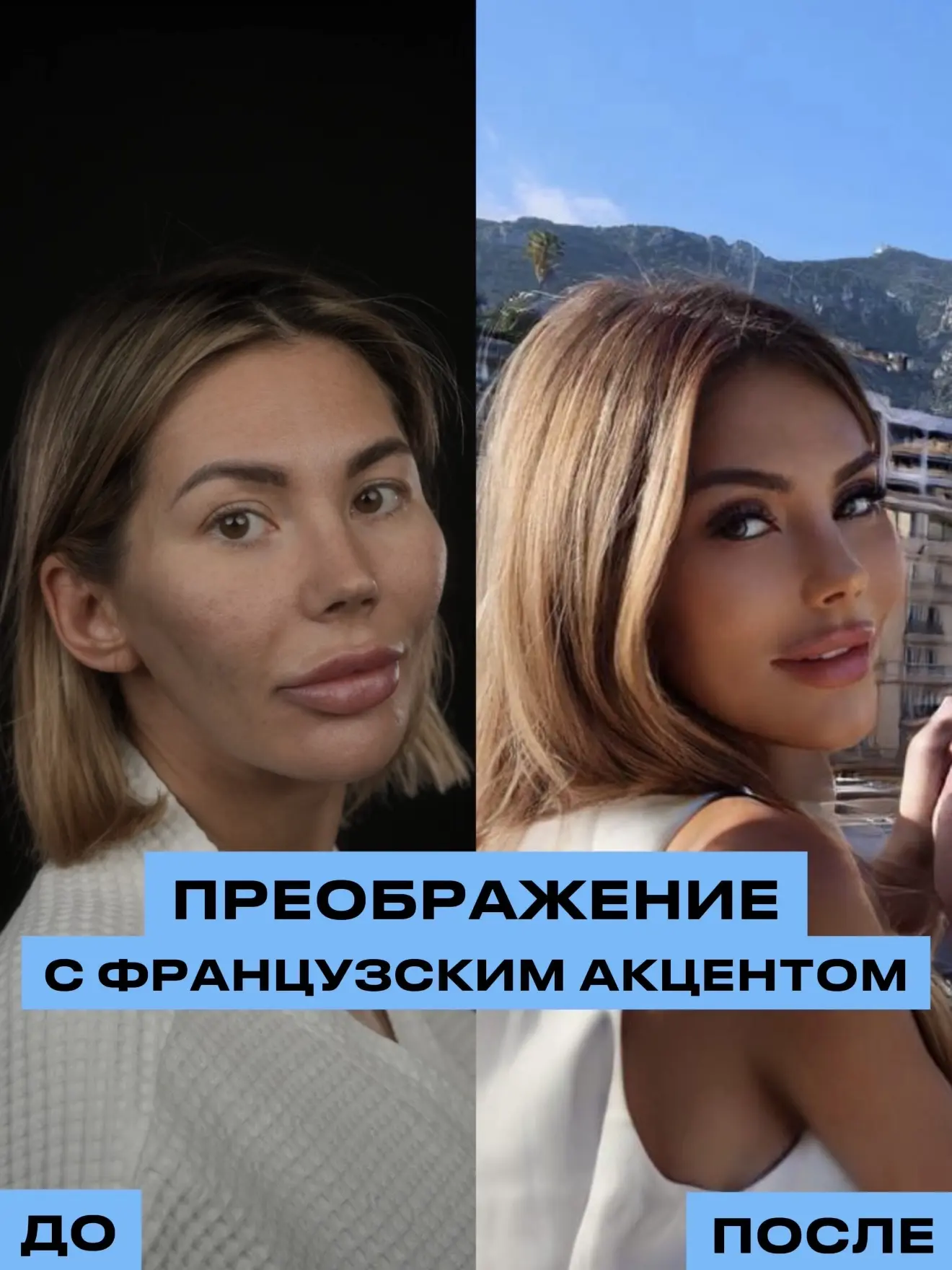 Пациентка прилетела специально ко мне из Франции👇🏻