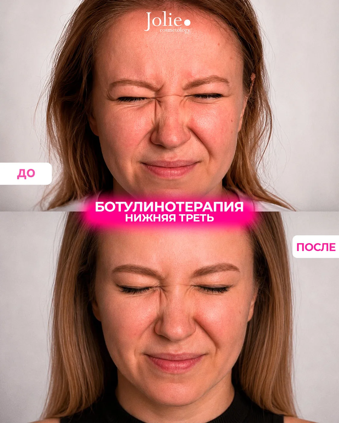 Пришла из-за «грустного лица», а в итоге начала менять отношение к себе

💗О нашей косметологии паци