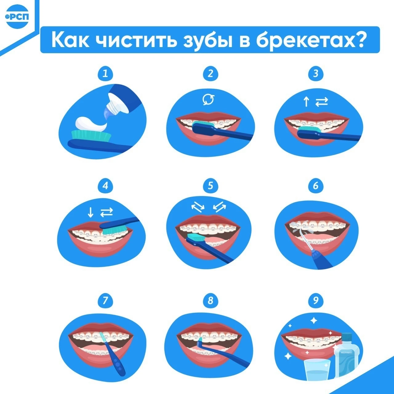 Если у вас установлены брекеты, то чистить зубы так, как вы делали это раньше, не получ...