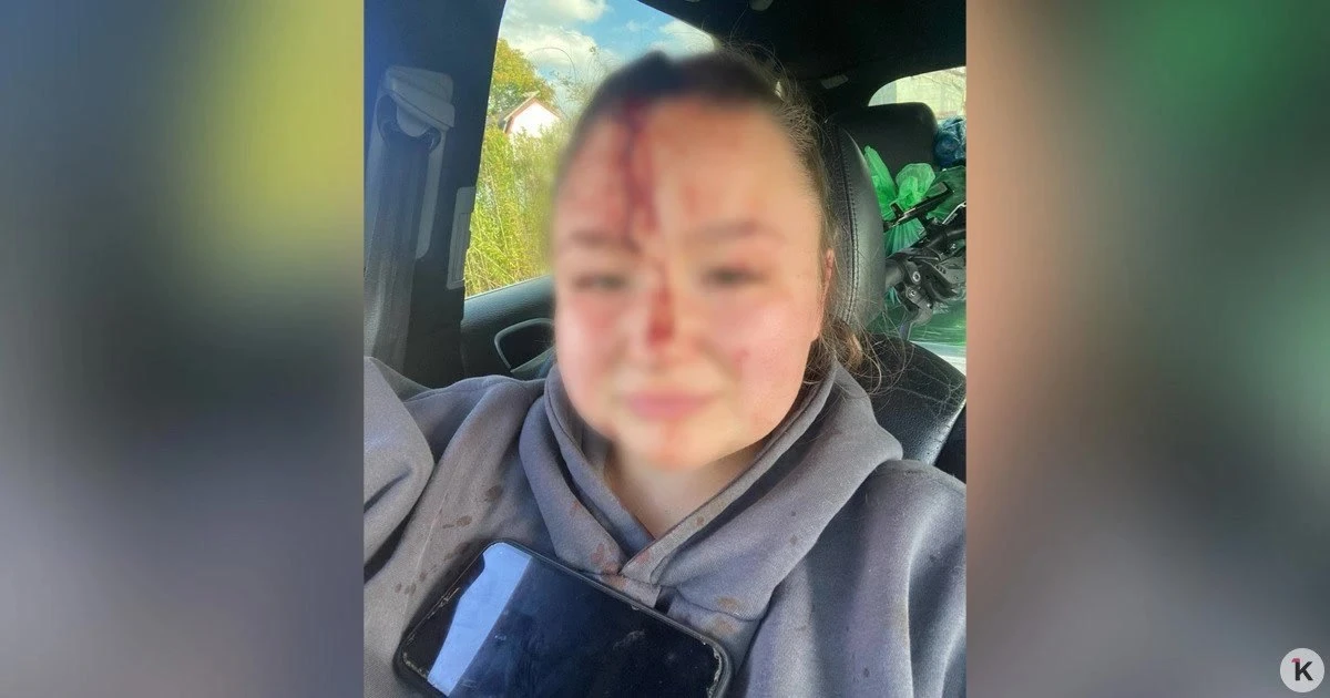 В Калининграде 22-летняя Екатерина получила удар гаечным ключом по голове во время семе...