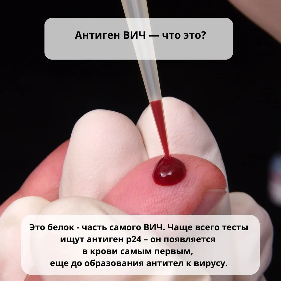 Вы знали, что диагноз ВИЧ-инфекция не ставится по результату одного анализа?

Только после подтвержд