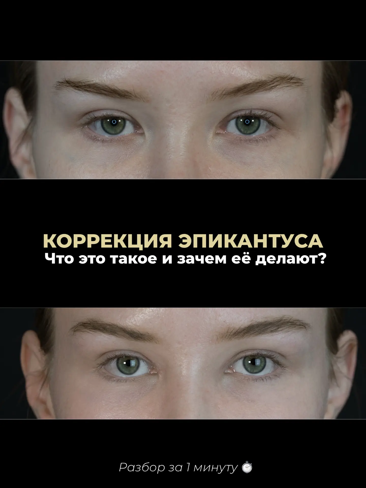 Что такое эпикантус и как при его наличии можно сделать взгляд более открытым? 👇🏻