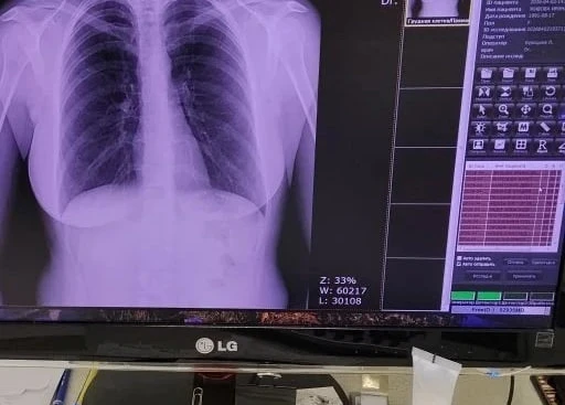 🏥 Рентгенслужба ЦГБ Арзамаса: гид для пациента