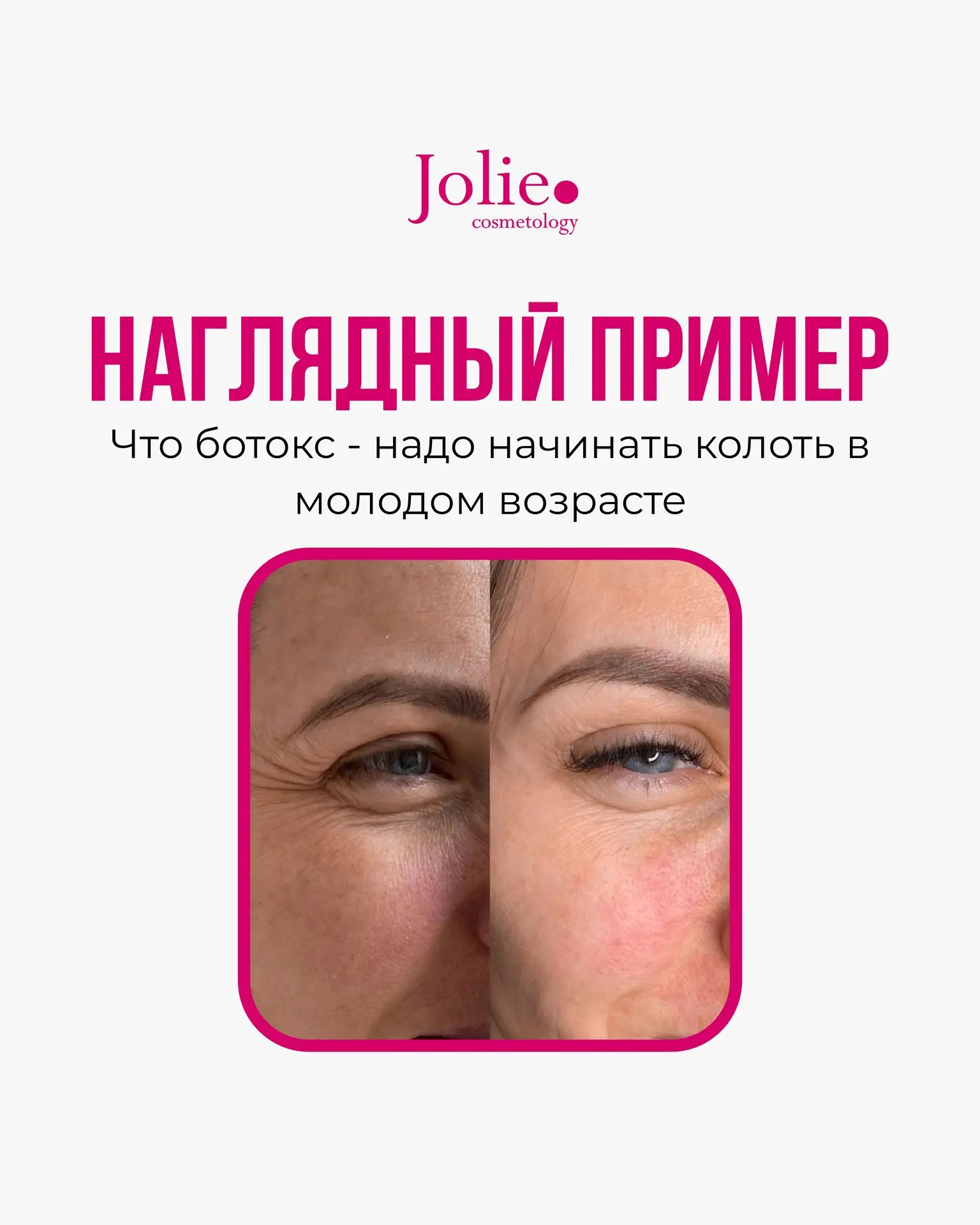 Лучше 1 раз увидеть, чем 100 раз услышать💗