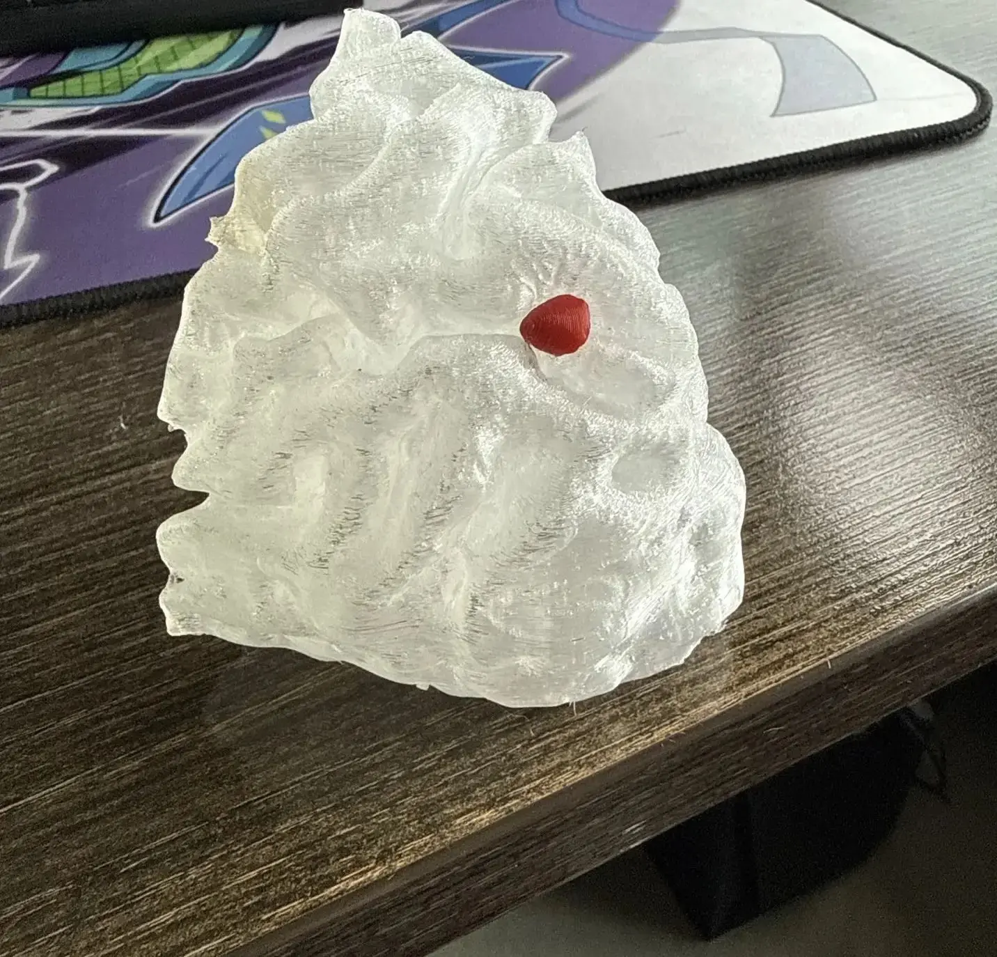 КОГДА МИЛЛИМЕТРЫ ИМЕЮТ ЗНАЧЕНИЕ: 3D-МОДЕЛЬ В ПЛАНИРОВАНИИ НЕЙРОХИРУРГИЧЕСКОЙ ОПЕРАЦИИ