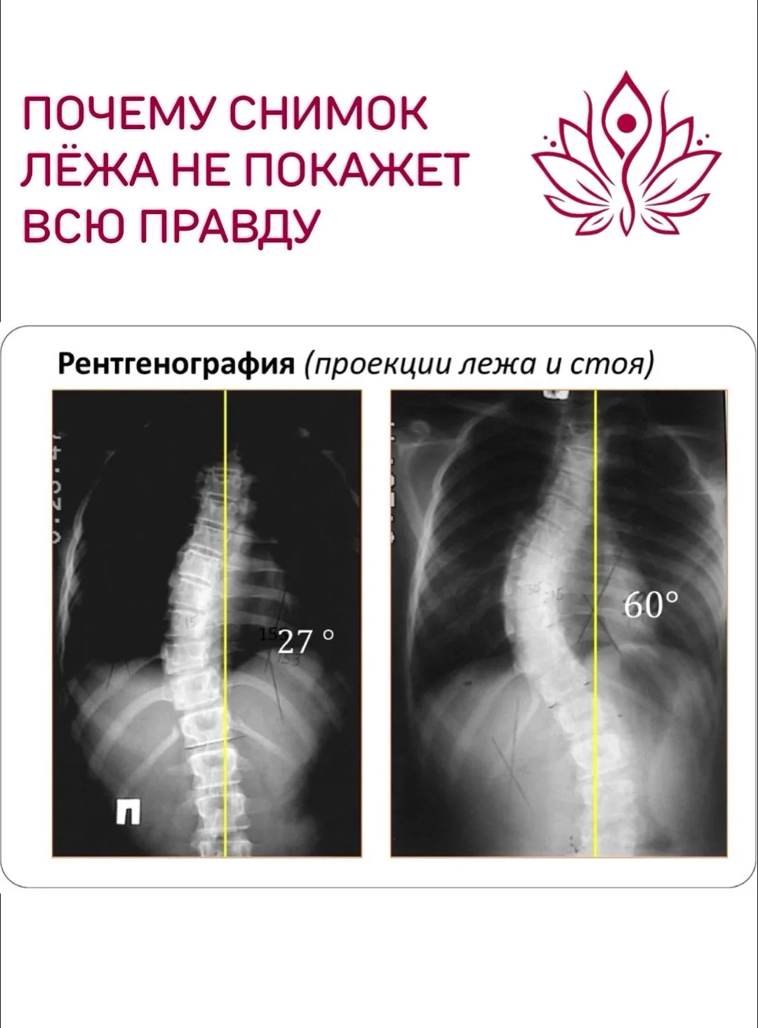 ПОЧЕМУ СНИМОК ЛЁЖА НЕ ПОКАЖЕТ ВСЮ ПРАВДУ
