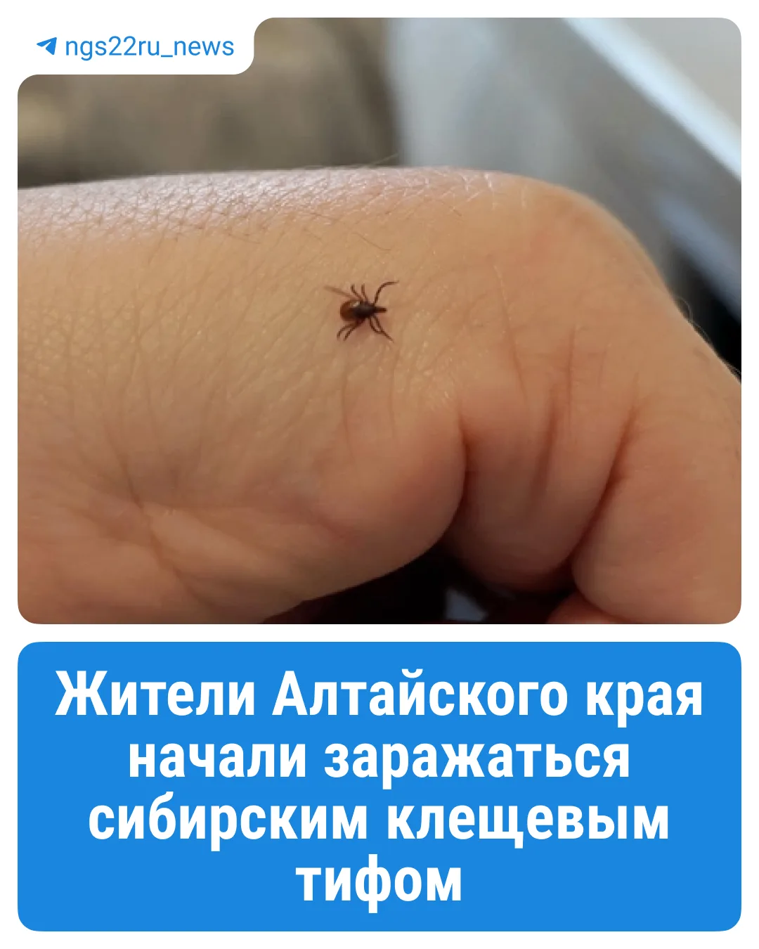 ❗️Заболеваемость сибирским клещевым тифом в Алтайском крае выросла на 81,5%

За 2025 год в крае заре