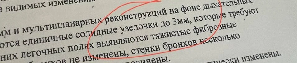 "Узелочки"🤗🤗🤗

А какие забавные формулировки попадались вам в практике, коллеги?
Делитесь!