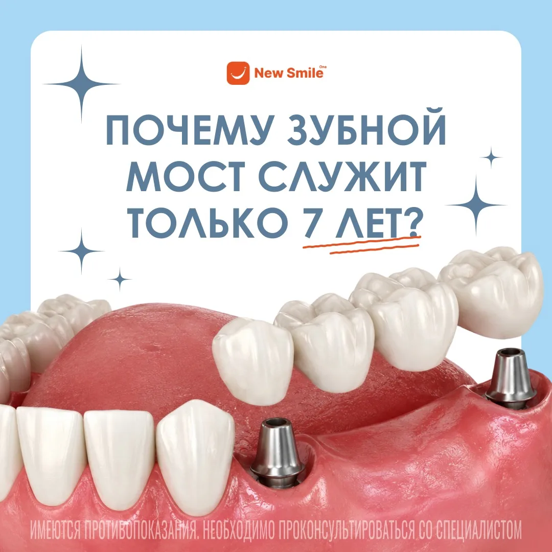 Пациенты выбирают мост ради экономии, но медицина говорит о другом. По статистике, чере...