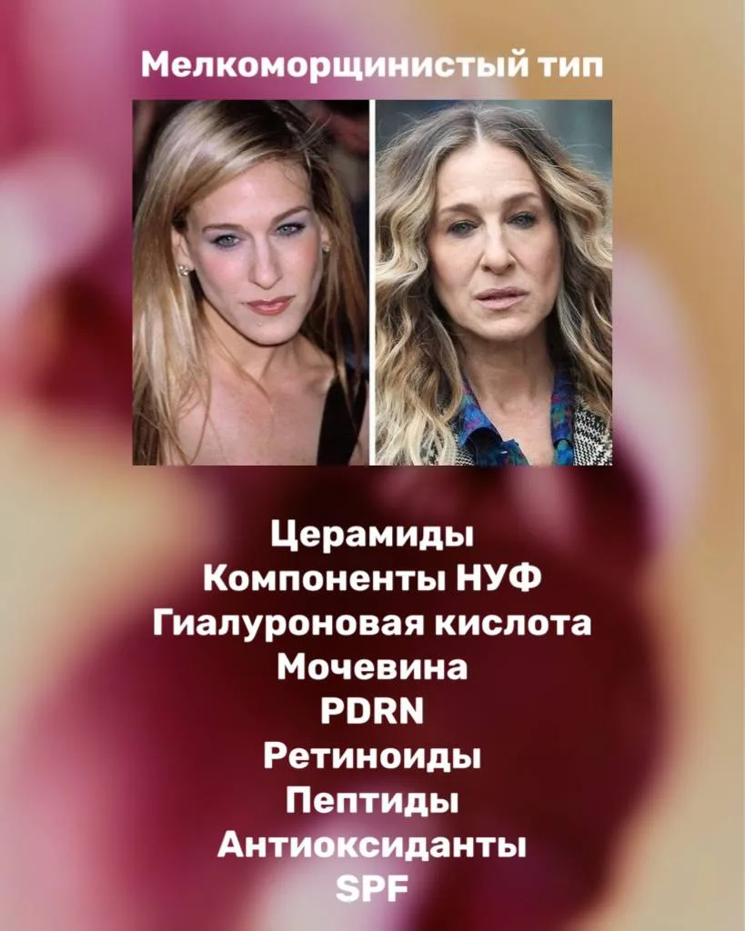 Типы старения.