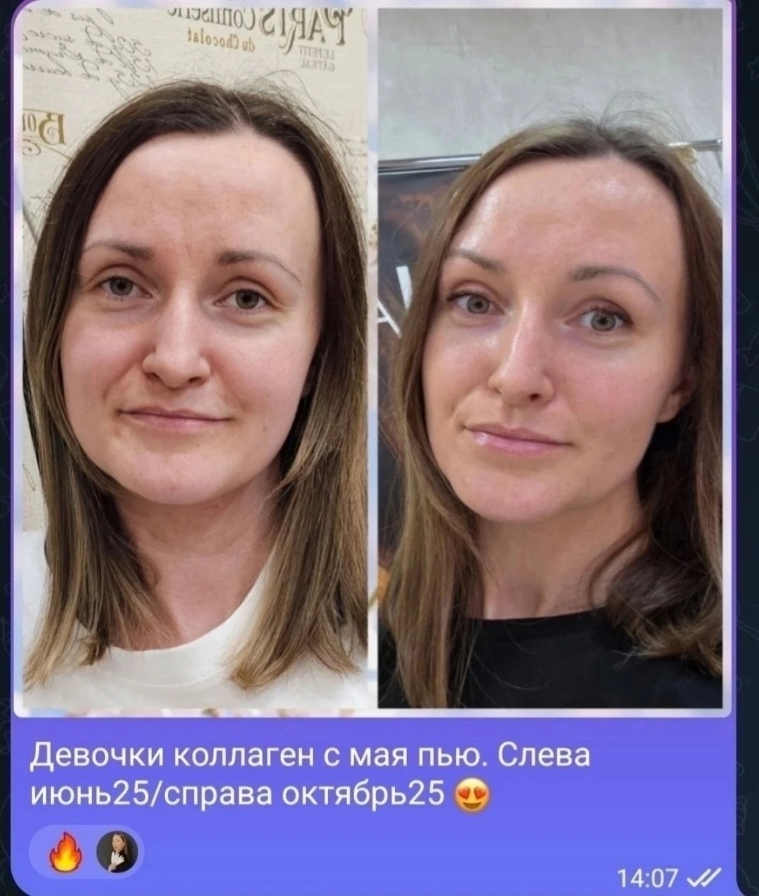 Отзыв