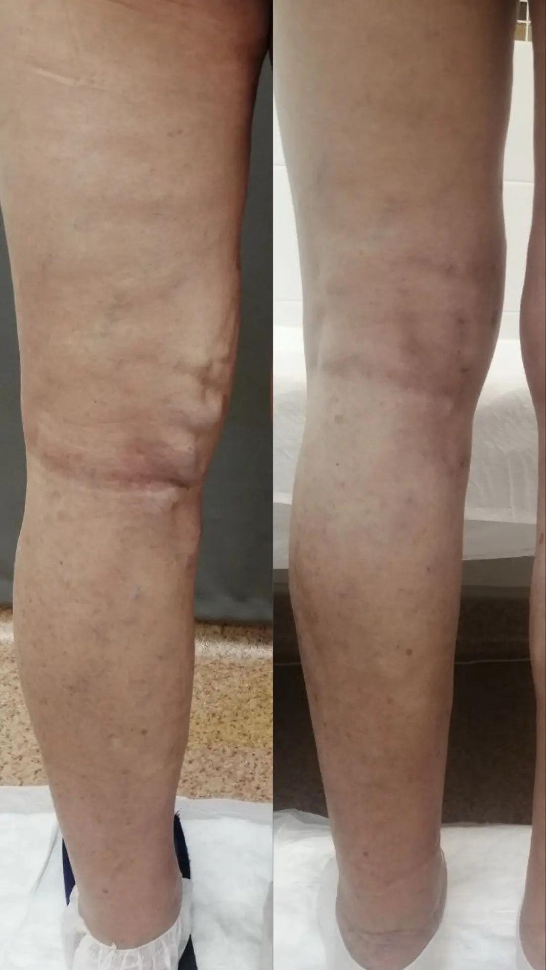 Клинический случай 👩‍⚕️