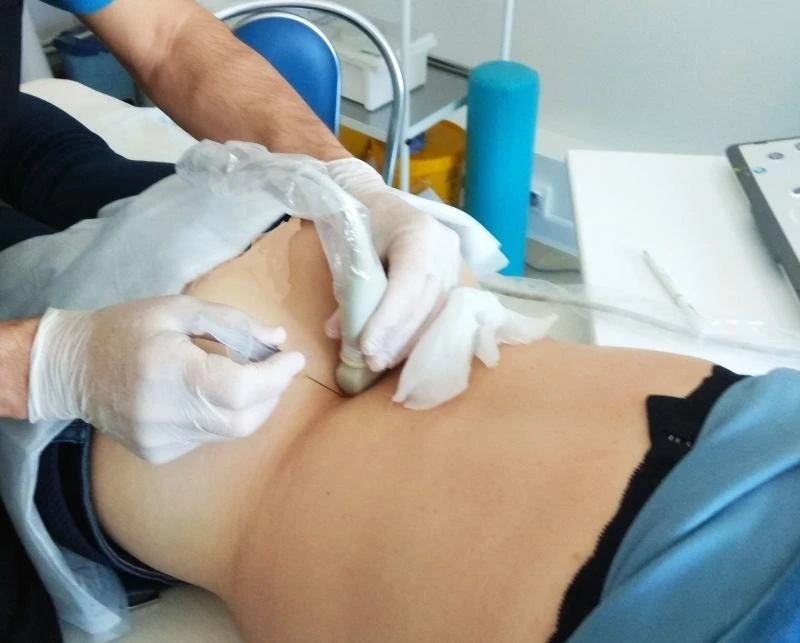 В Уфе врача-нейрохирурга будут судить за смерть пациентки