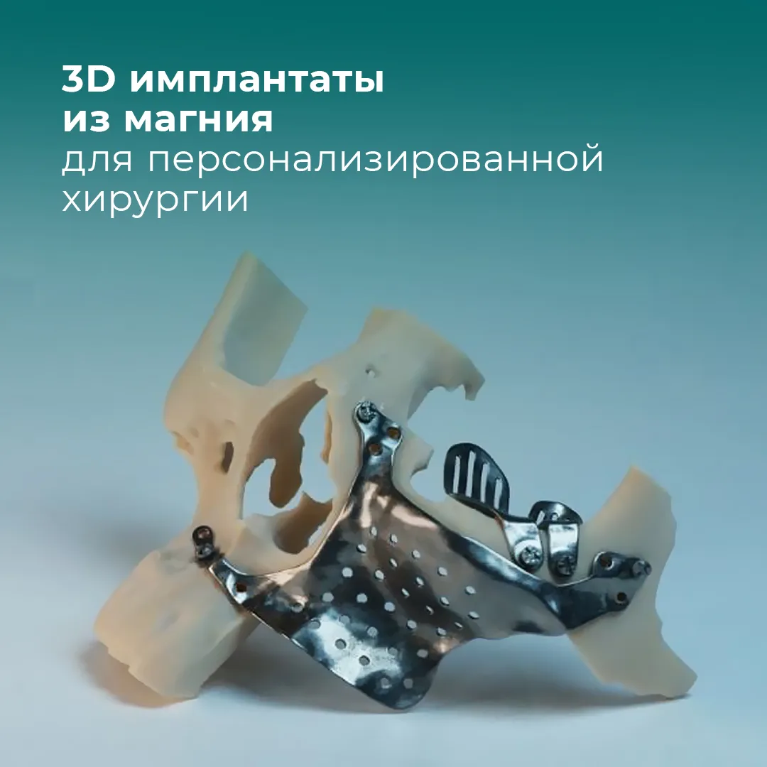 ⭐️3D имплантаты из магния для персонализированной хирургии  3D печать в хирургии: опыт OsseoLabs.  И