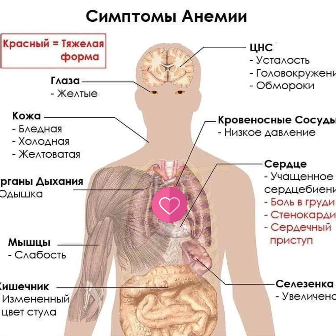 🗣Что нужно есть при железодефиците?  В первую очередь «налегайте» на куриную печень, говядину, кроль