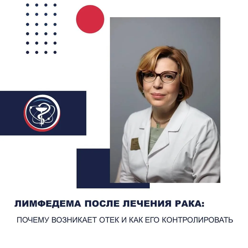 ЛИМФЕДЕМА ПОСЛЕ ЛЕЧЕНИЯ РАКА: ПОЧЕМУ ВОЗНИКАЕТ ОТЕК И КАК ЕГО КОНТРОЛИРОВАТЬ