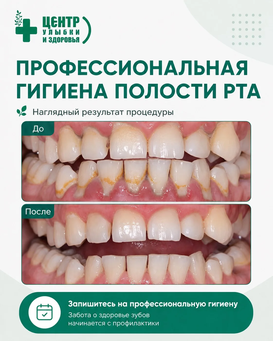 🩺 Профессиональная гигиена полости рта — это не маркетинг.