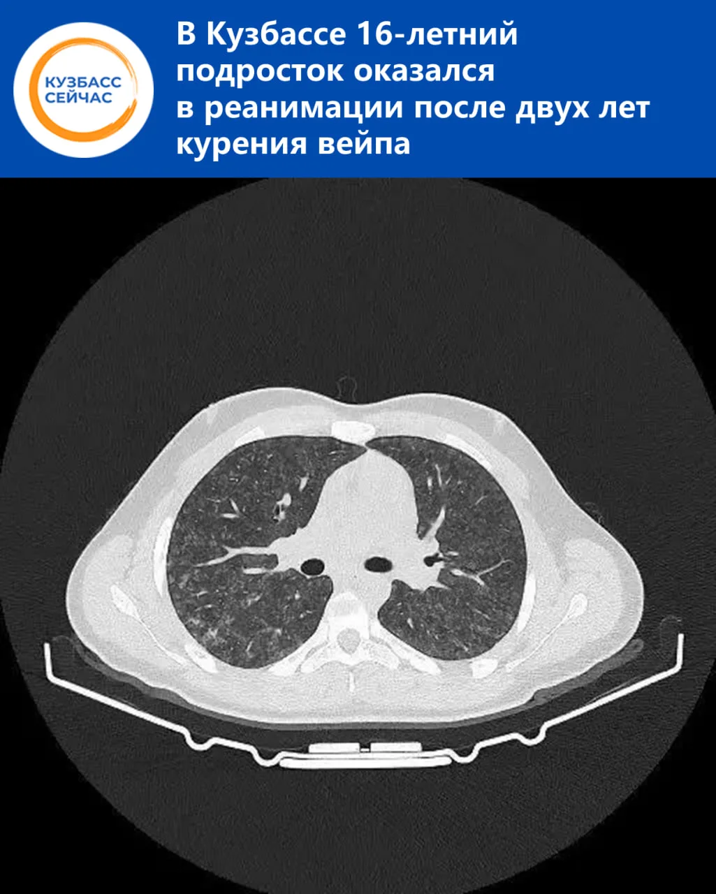 Сначала парень поступил в детскую больницу с пневмонией — вылечился и был выписан.
